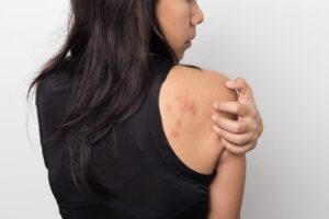 woman itching